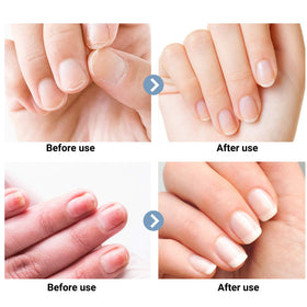 Generic Nail Clippers operate quietly, helping maintain a calm grooming session