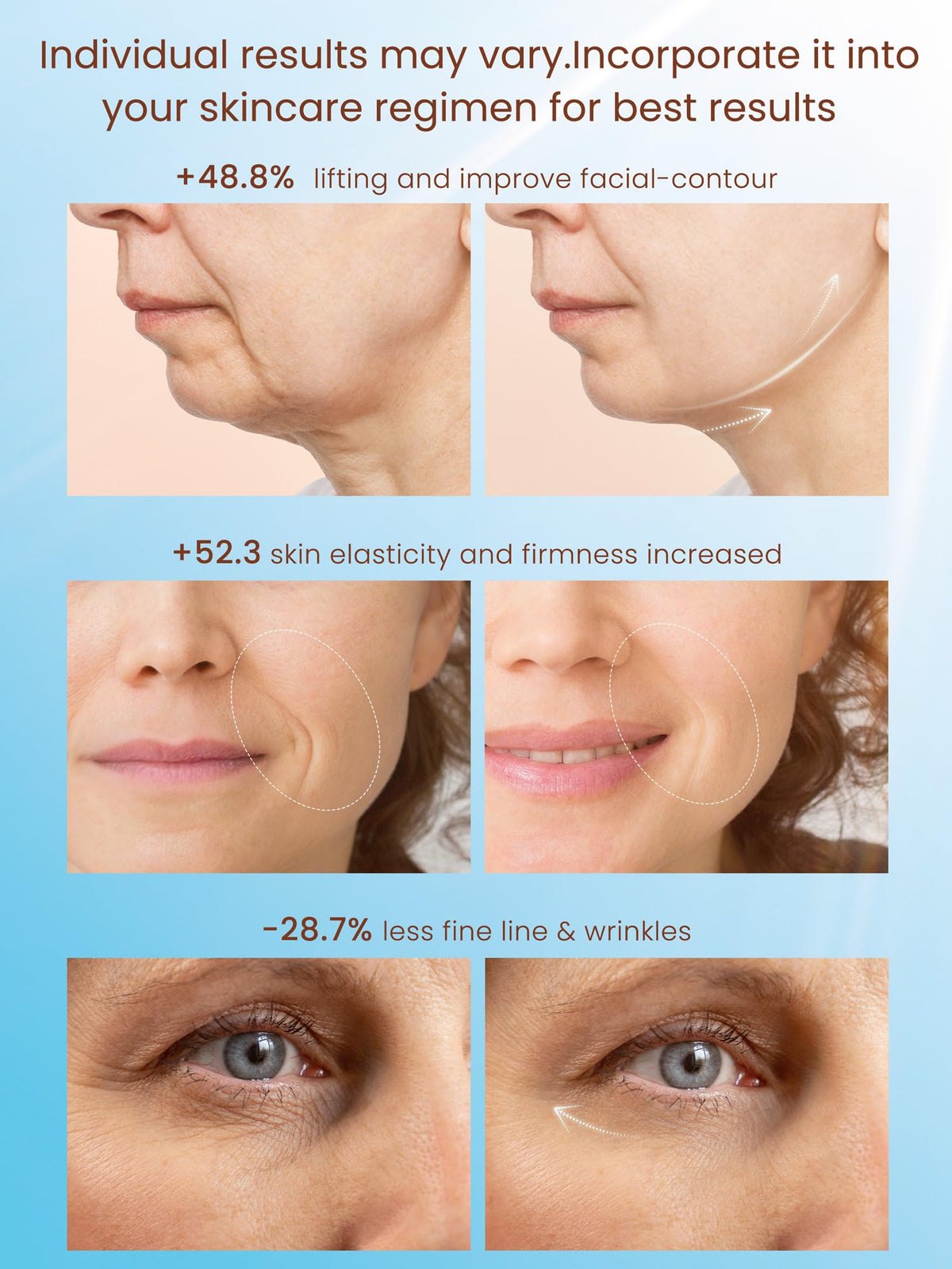 Generic red LED therapy light enables collagen boost during treatment