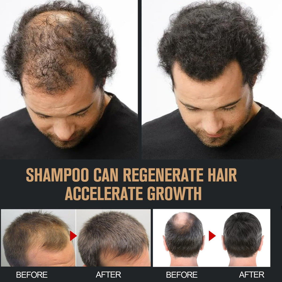 Generic Root Activator Shampoo in shower illustrates simple scalp massage routine