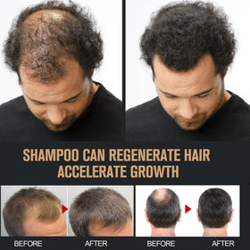 Generic Root Activator Shampoo in shower illustrates simple scalp massage routine