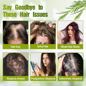 Generic Rosemary Hair Growth Shampoo ingredients label shows rosemary and keratin.