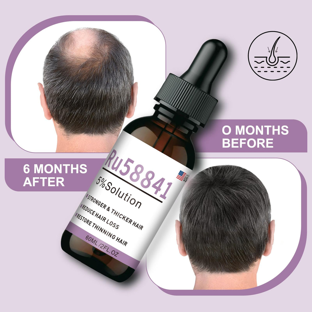 Generic RU58841 routine for all hair types seeking thicker-looking hair.