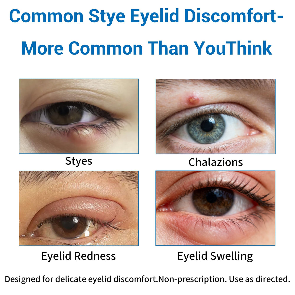 Generic Stye Eye Treatment packaging-shot communicates daily eyelid care readiness.