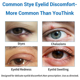 Generic Stye Eye Treatment packaging-shot communicates daily eyelid care readiness.