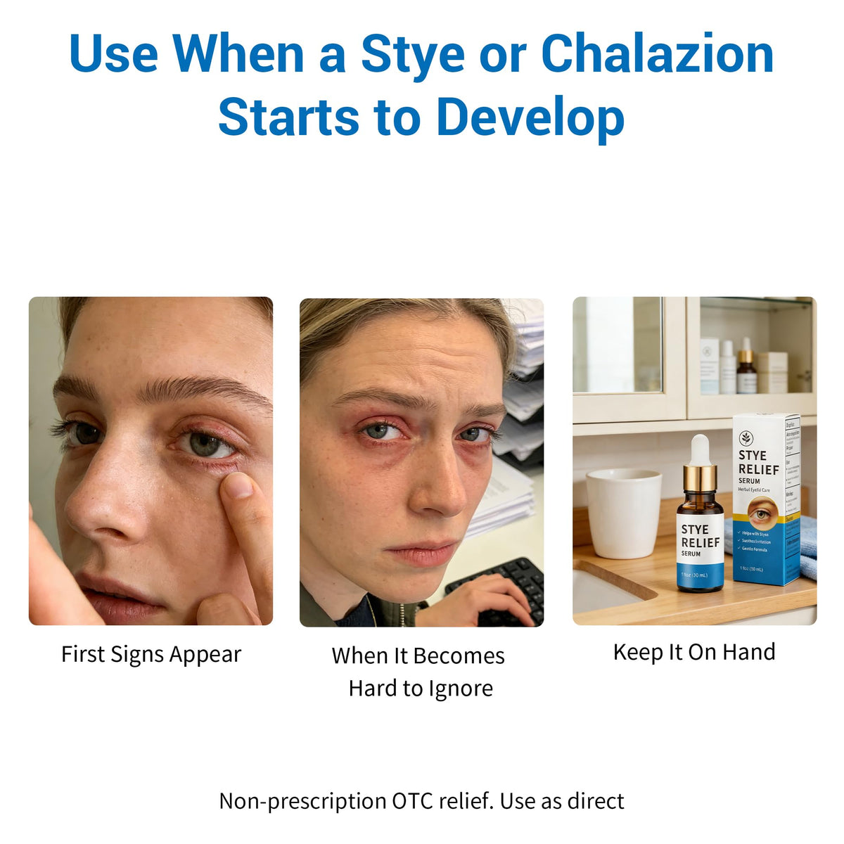 Generic Stye Eye Treatment sensitive-eyelids-use shows skin-friendly eyelid care.