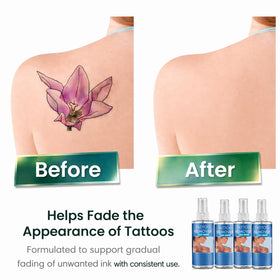 Generic Tattoo Removal Cream being applied to skin for gradual change.