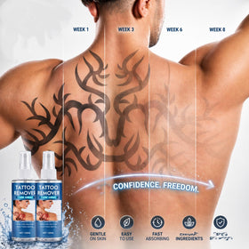 Generic Tattoo Removal Cream packaging highlighting a cosmetic solution.