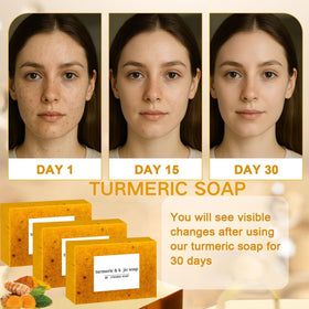Generic turmeric soap targets spots for a more even tone appearance.