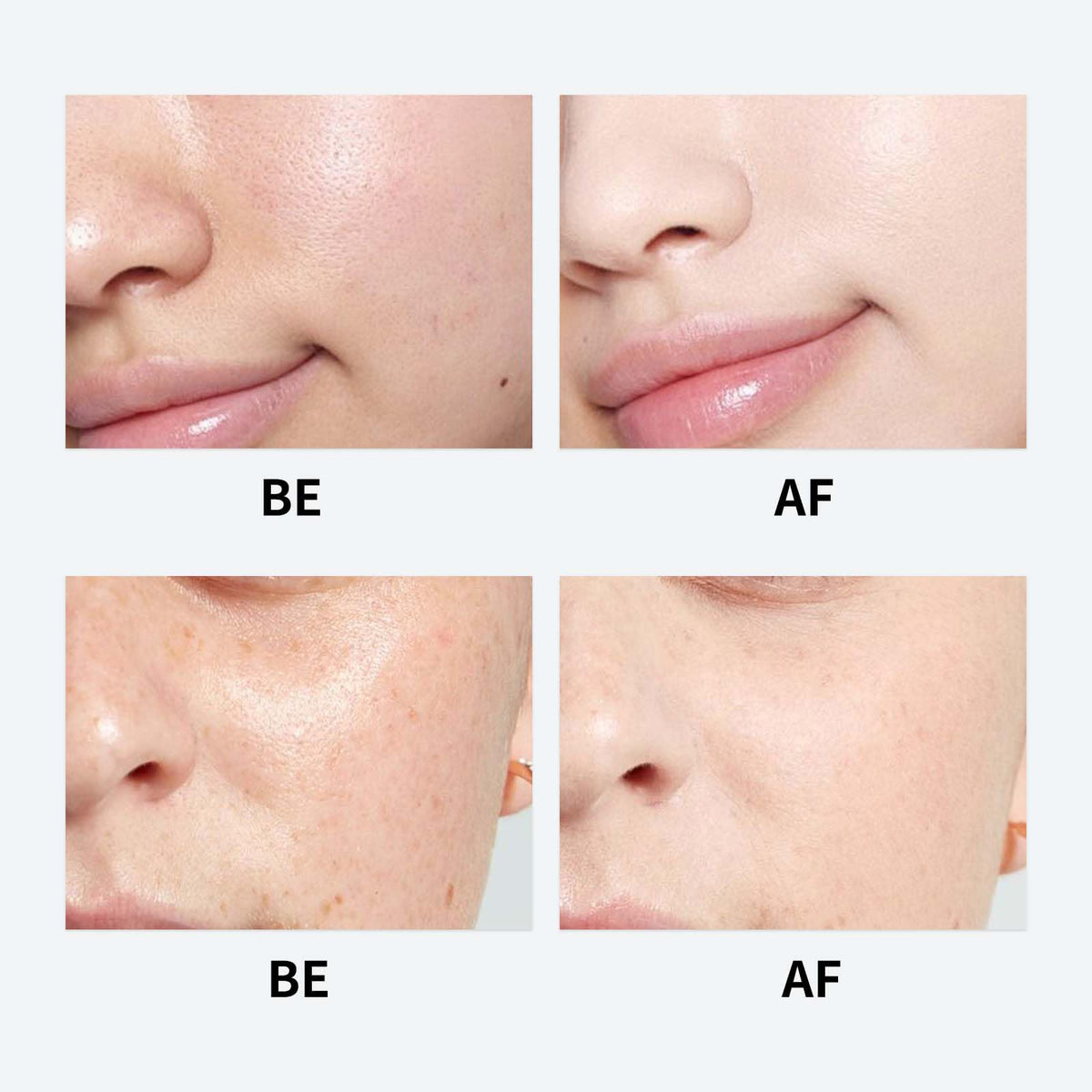 Generic Youthful Formula Centella moisturizer jar highlights lightweight formula.