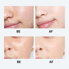 Generic Youthful Formula Centella moisturizer jar highlights lightweight formula.