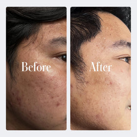 Geologie close-up of improved skin texture after use.