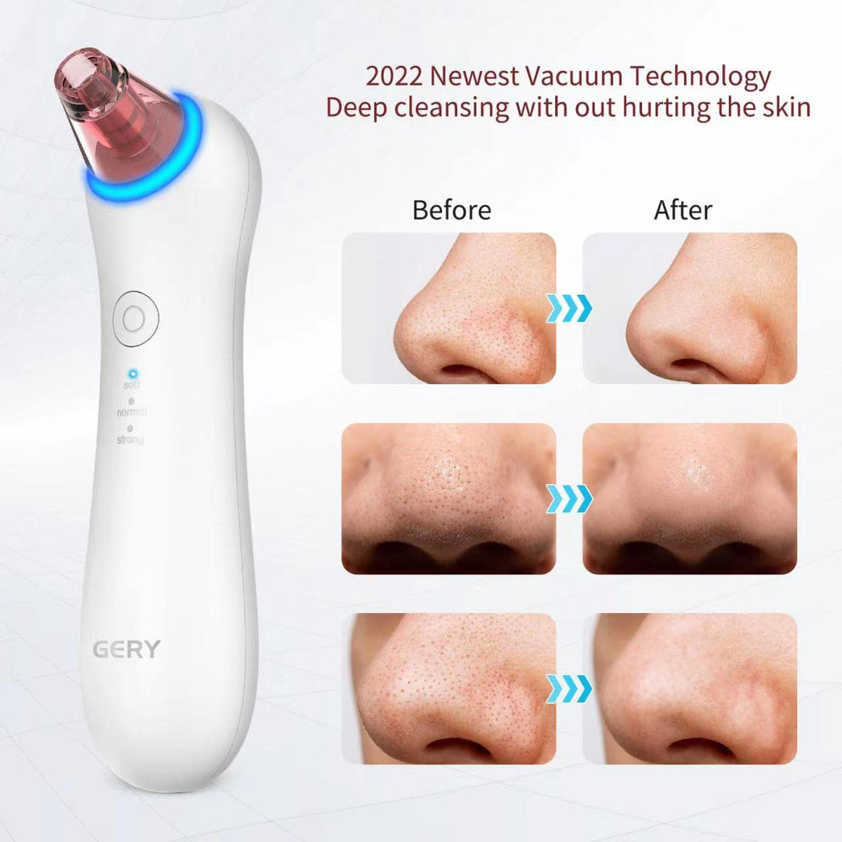 GERY suction heads kit with four pieces for targeted facial areas.