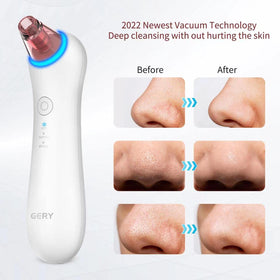 GERY suction heads kit with four pieces for targeted facial areas.