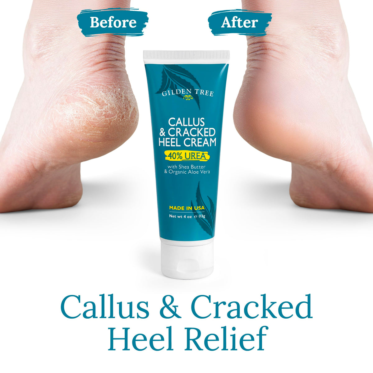 GILDEN TREE cracked heel treatment shows application for smoother skin.