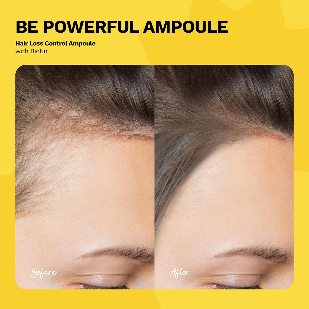 Ginger Milk Ampoule nourishing vitamins for hair health