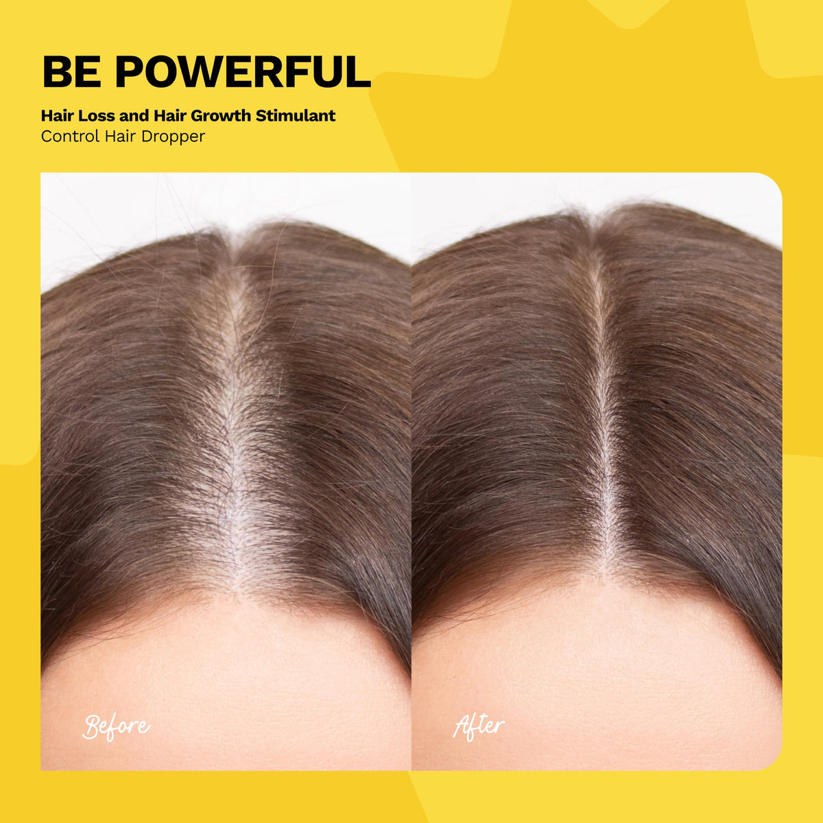 Ginger Milk Natural Care rosemary extract bottle showcases scalp-supporting ingredients.