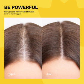Ginger Milk Natural Care rosemary extract bottle showcases scalp-supporting ingredients.