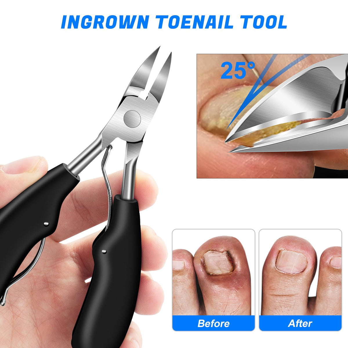 GJNL angled-head toenail clipper offers precise cuts with clear blade visibility