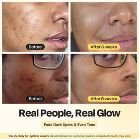 Texture being spread on skin with Gleamin Advanced Brightening Moisturizer