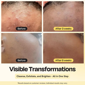 Close-up of foam texture from Gleamin cleanser, indicating gentle exfoliation.