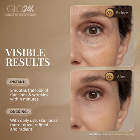 GLO24K Hexapeptide-8 anti-wrinkle illustration suggests smoothing at the surface.