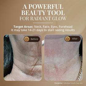 GLO24K vibration technology boosts serum or moisturizer absorption.
