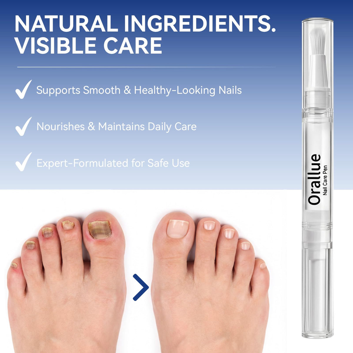 Glopink Nail Care Pen resting on desk for quick touch ups