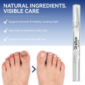 Glopink Nail Care Pen resting on desk for quick touch ups