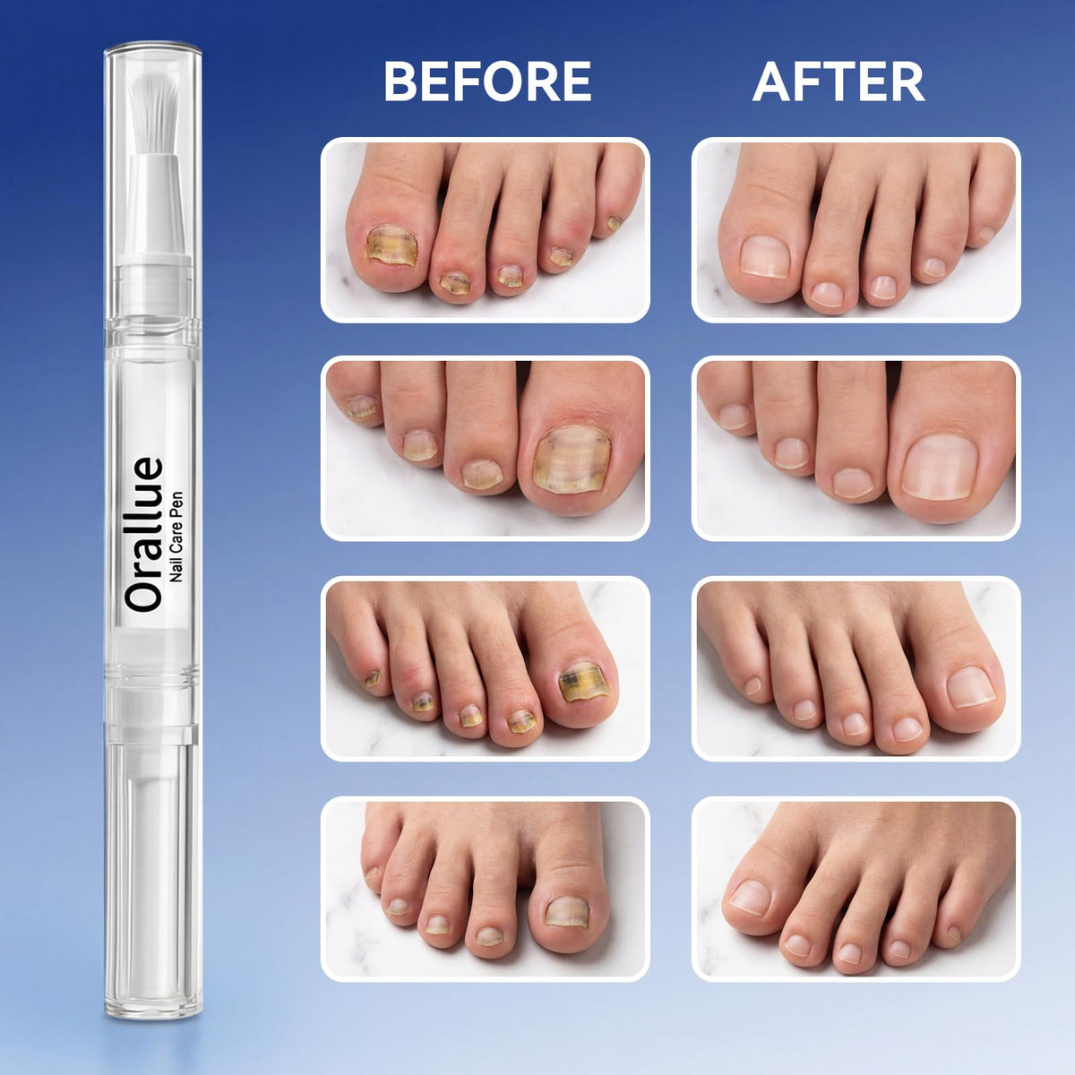 Glopink Nail Care Pen close up shows lightweight non greasy texture