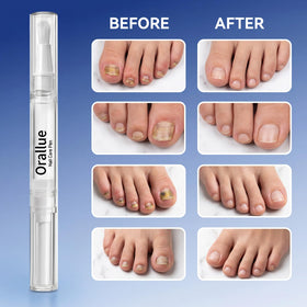 Glopink Nail Care Pen close up shows lightweight non greasy texture