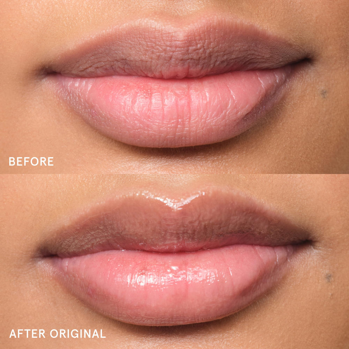 Clear formula hydration for daily use on lips and patches.