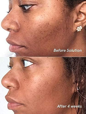 Glossier Solution pump-top close-up highlights gentle exfoliation for even skin tone.