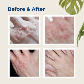 Gloves In A Bottle Shielding Lotion hands applying for task protection.