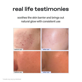 Glow Aloe Barrier texture closeup highlights light, non-greasy cream absorbing quickly.