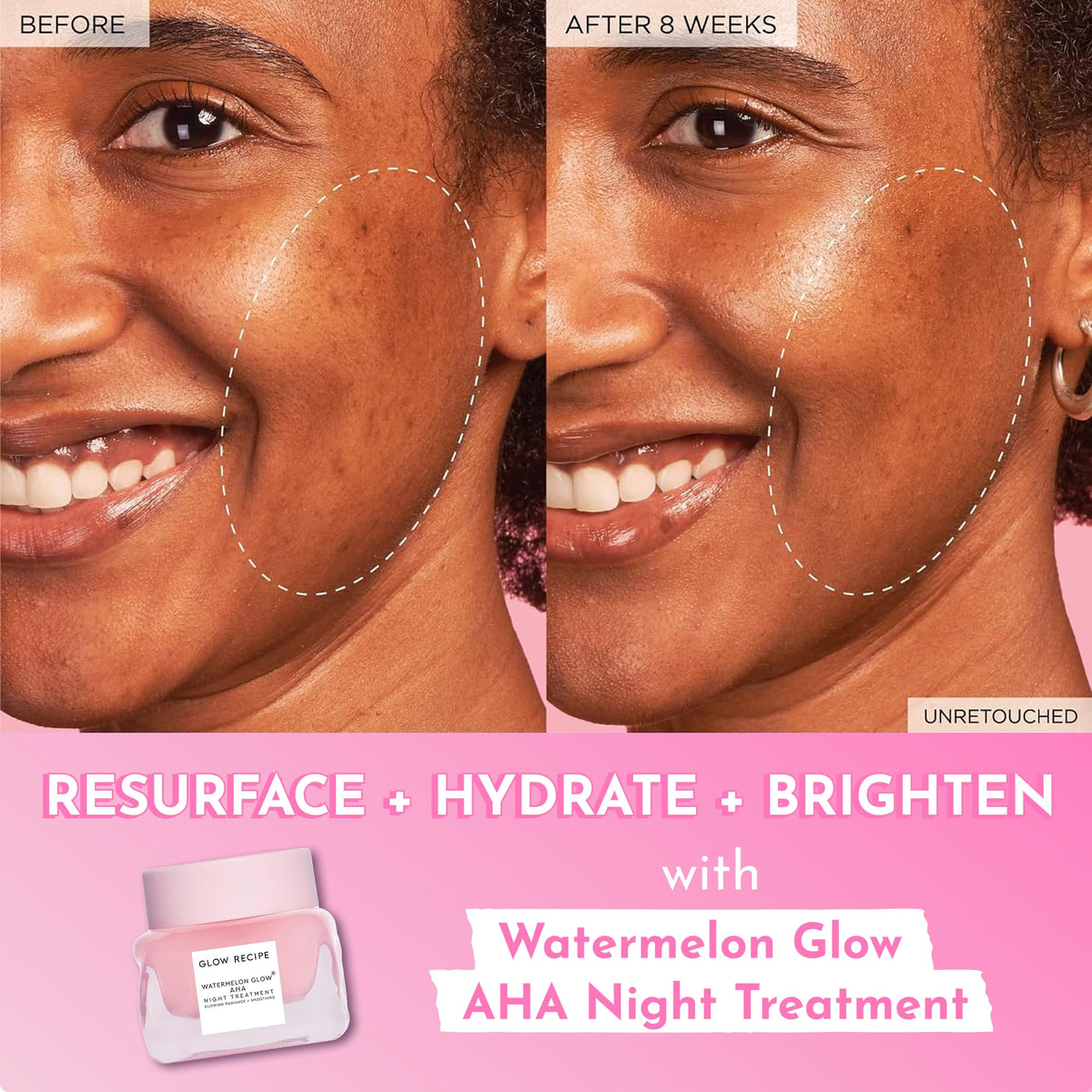 Glow Recipe Watermelon Glow AHA Night Treatment gel texture close-up ready for application.
