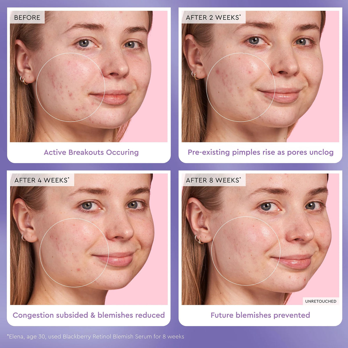 Glow Recipe Gentle Blackberry Retinol Serum night routine setup with timer suggests consistent use.