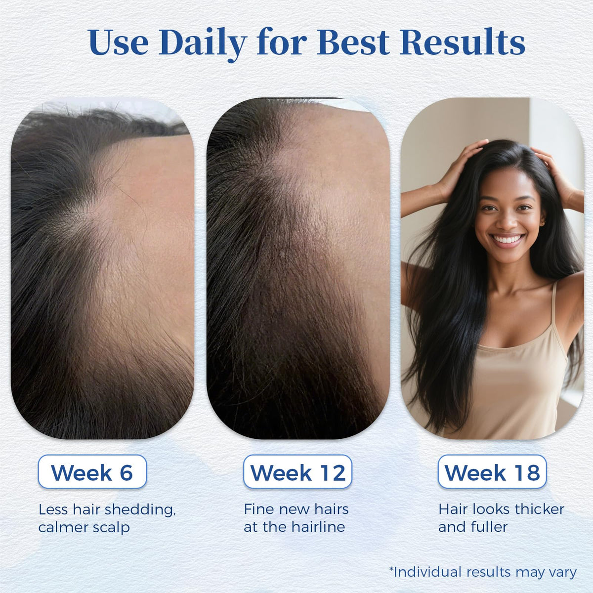 Gluvelessia stainless-steel roll-on head for clean, even coverage