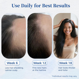 Gluvelessia stainless-steel roll-on head for clean, even coverage