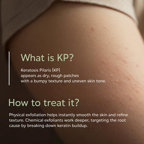 Glycology KP bump eraser body scrub tub targets red bumps and dull texture.