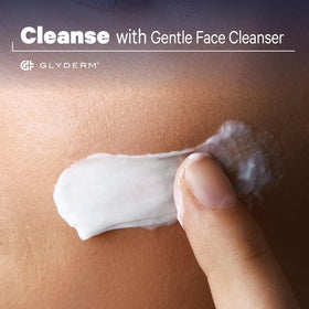 GlyDerm product shot on bathroom shelf highlighting 0.2% esterified glycolic acid