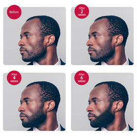Godefroy night-time application image hints at overnight conditioning results.