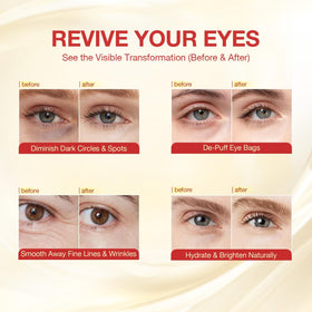 GONIM retinol-niacinamide patches smooth texture and hydrate the eye area.