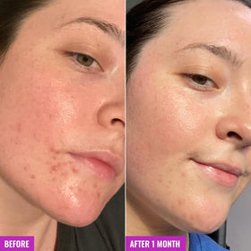 Good Molecules Clarify Bar creamy lather demonstrating non-drying cleansing