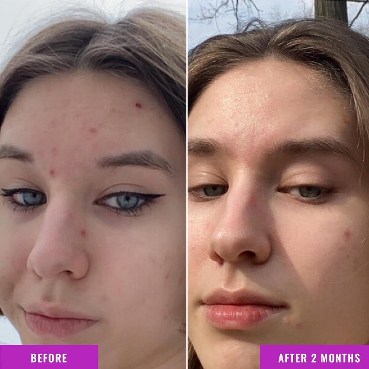 Good Molecules Niacinamide Serum Pack 3 dispense close-up reveals lightweight formula.