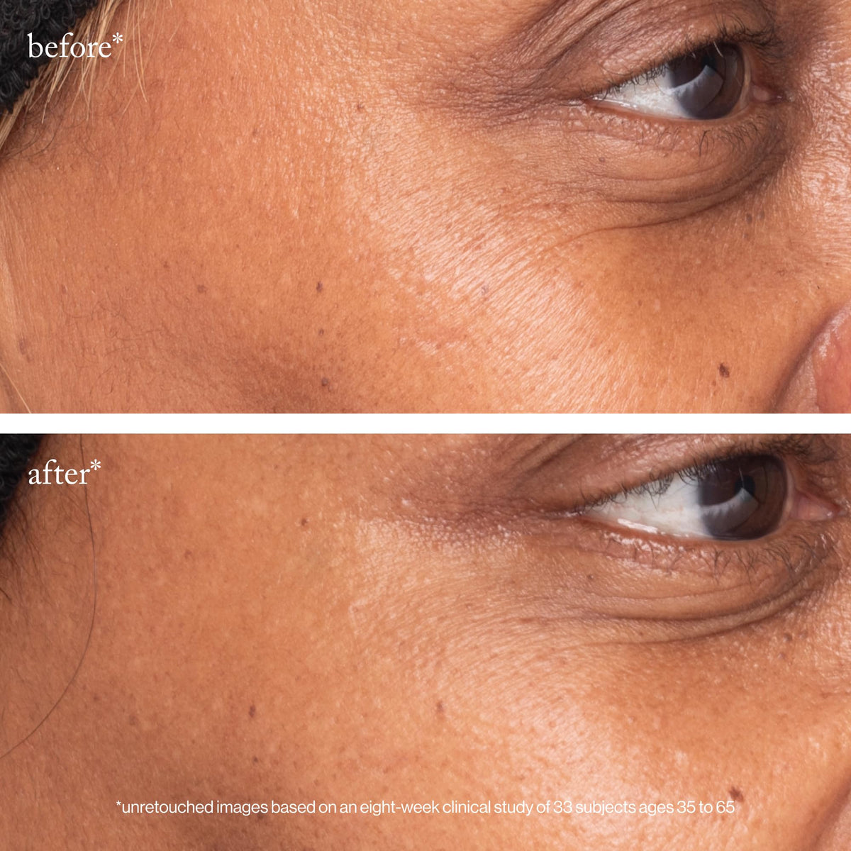 goop Beauty 3x Retinol Eye Lift Serum being applied under the eye for targeted skincare.