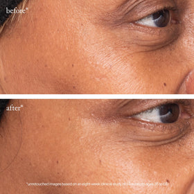 goop Beauty 3x Retinol Eye Lift Serum being applied under the eye for targeted skincare.