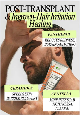 GPC Green Pharm Cosmetic after-sun relief on sun-exposed skin.