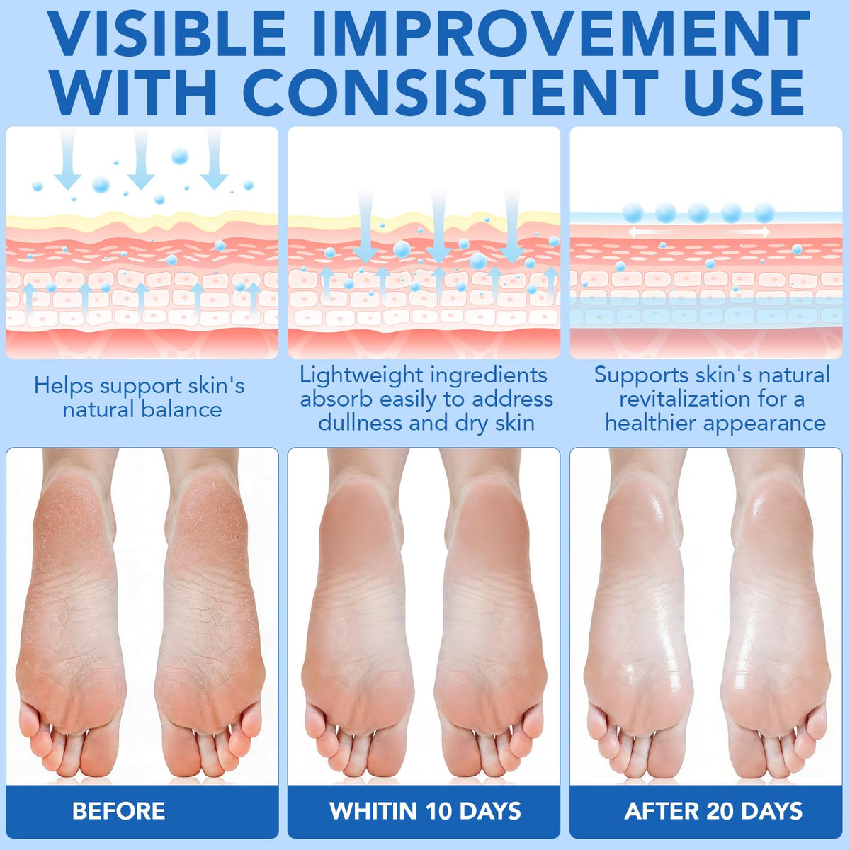 GPUPFJPW Elbows, knees, and hands benefit from gentle exfoliation.