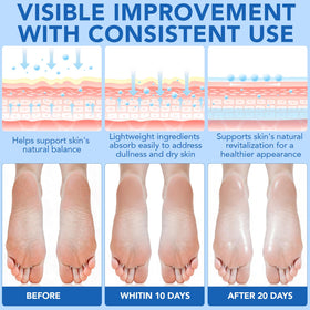GPUPFJPW Elbows, knees, and hands benefit from gentle exfoliation.