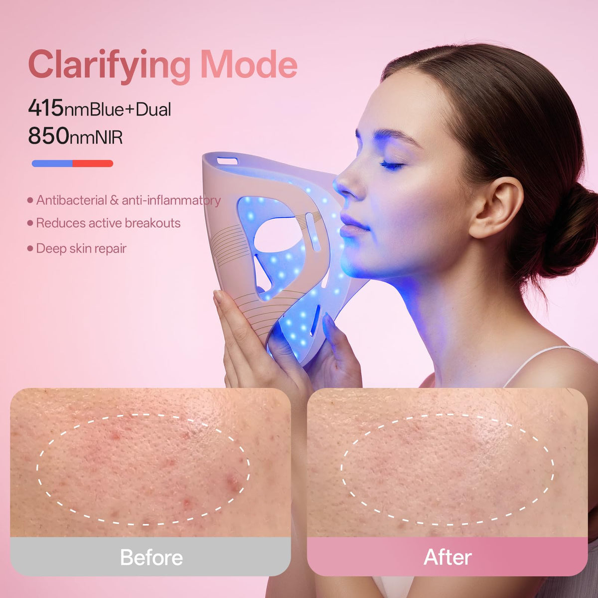Graart three wavelengths support varied skincare needs